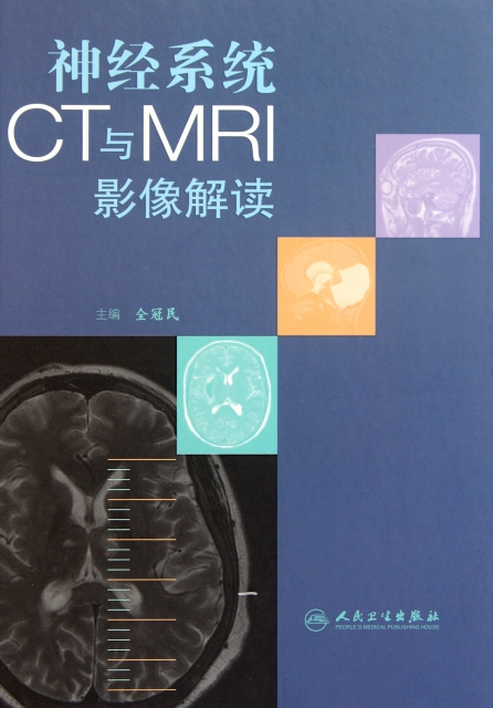 神經繫統CT與MRI影像解讀(精)