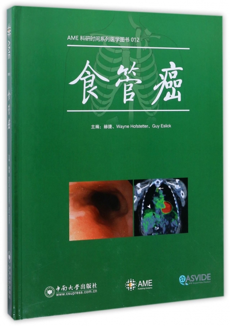 食管癌(精)/AME科研時間繫列醫學圖書