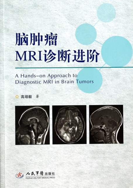 腦腫瘤MRI診斷進階