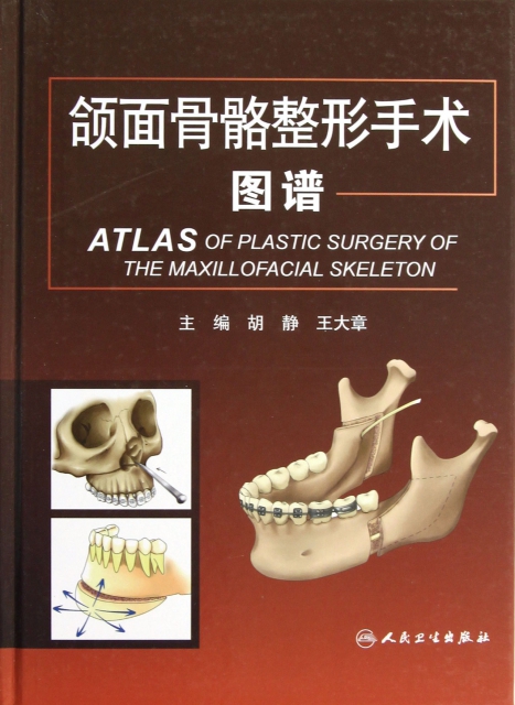 頜面骨骼整形手術圖譜(精)