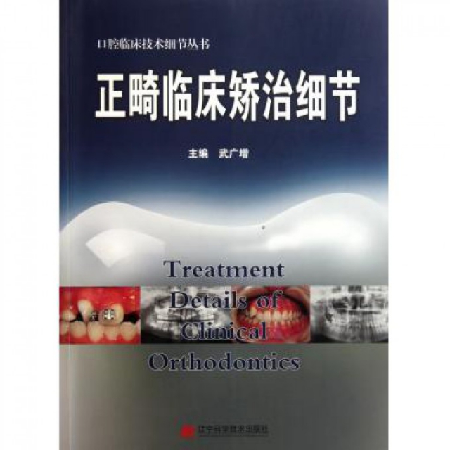 正畸臨床矯治細節/口腔臨床技術細節叢書