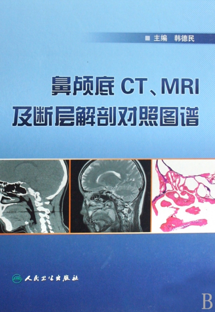 鼻顱底CTMRI及斷層解剖對照圖譜(精)