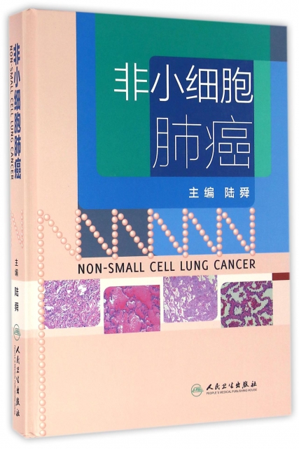 非小細胞肺癌(精)