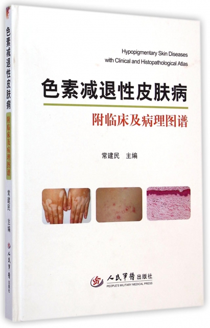色素減退性皮膚病(附臨床及病理圖譜)(精)