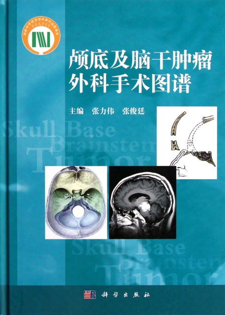顱底及腦干腫瘤外科手術圖譜(精)