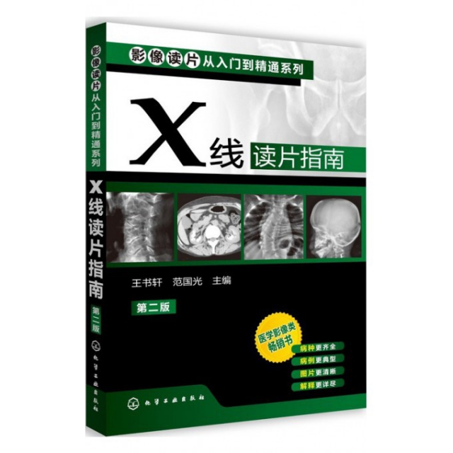 X線讀片指南(第2版