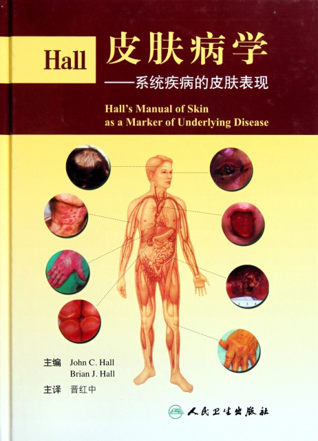 Hall皮膚病學--繫統疾病的皮膚表現(精)