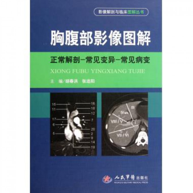 胸腹部影像圖解(正常解剖-常見變異-常見病變)(精)/影像解剖與臨床圖解叢書