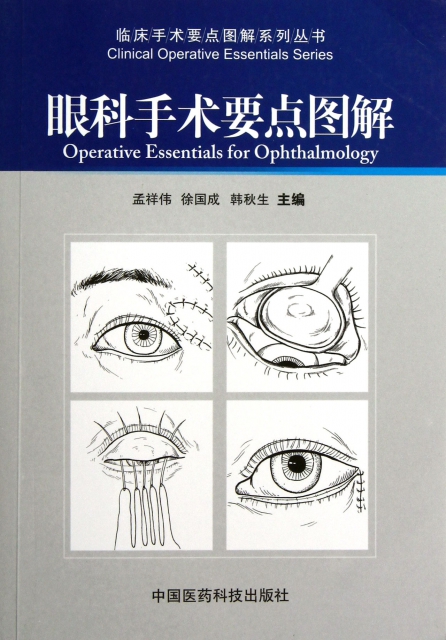 眼科手術要點圖解/臨床手術要點圖解繫列叢書