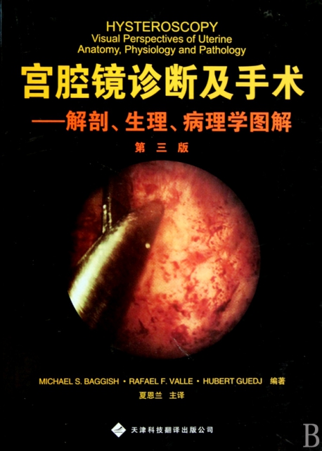 宮腔鏡診斷及手術--解剖生理病理學圖解(第3版)(精)