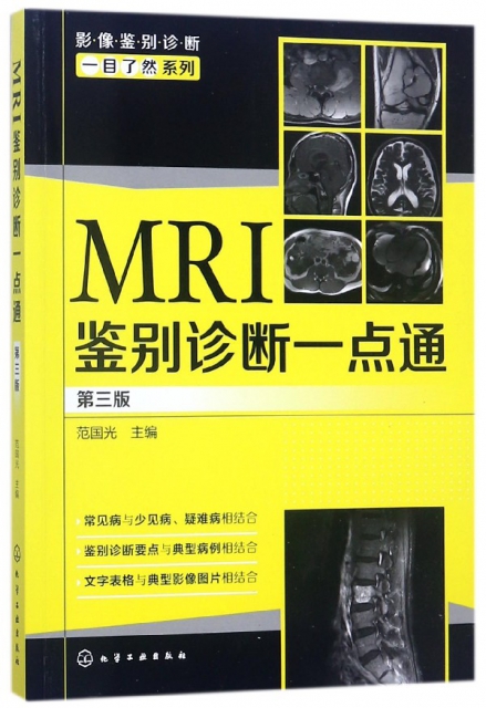 MRI鋻別診斷一點通(第3版)/影像鋻別診斷一目了然繫列