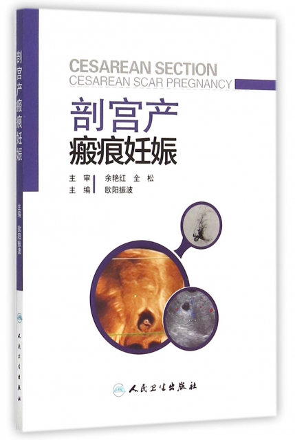 剖宮產瘢痕妊娠
