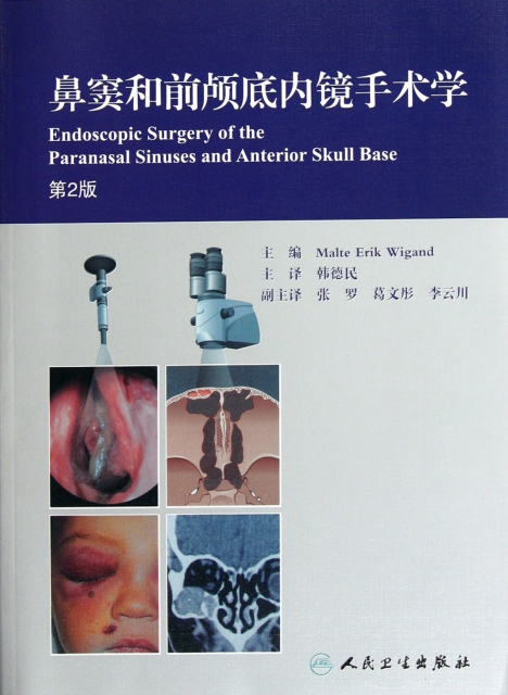 鼻竇和前顱底內鏡手術學(第2版)