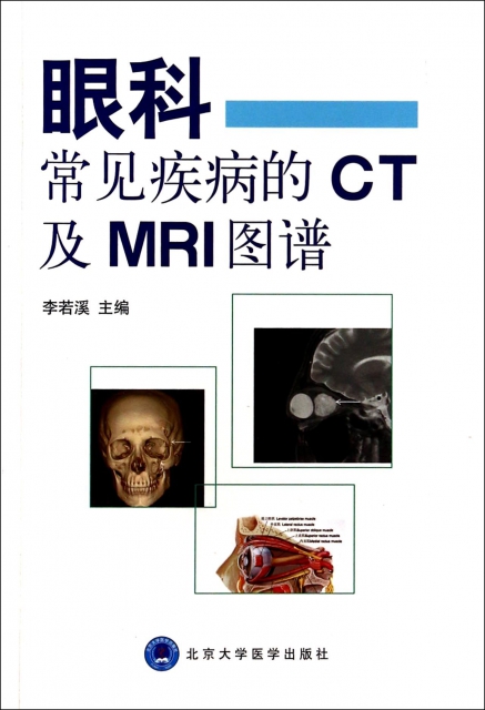 眼科常見疾病的CT及MRI圖譜