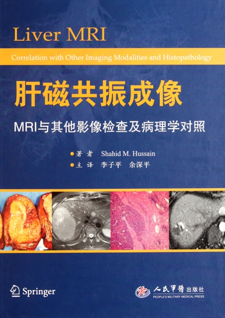 肝磁共振成像(MRI與其他影像檢查及病理學對照)(精)
