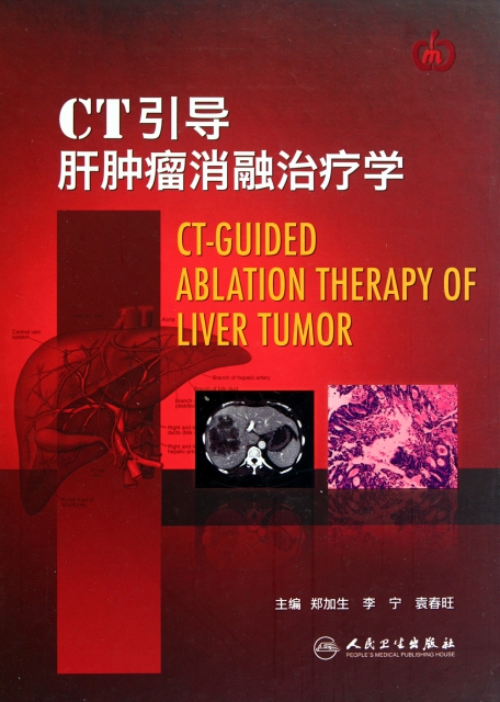 CT引導肝腫瘤消融治療學(精)