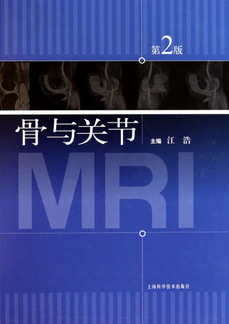 骨與關節MRI(第2版)(精)