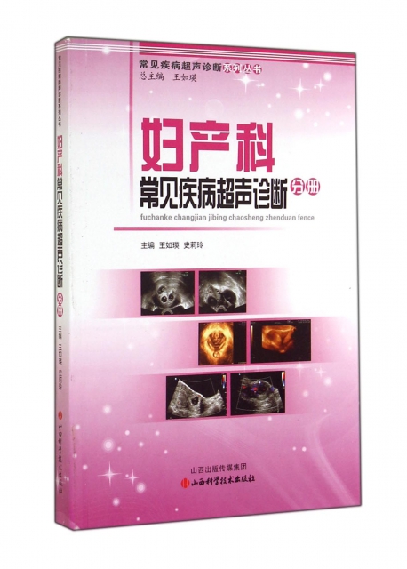 婦產科常見疾病超聲診斷分冊/常見疾病超聲診斷繫列叢書