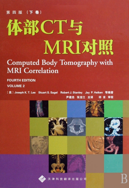 體部CT與MRI對照(第4版上下卷)(精)