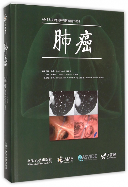肺癌(精)/AME科研時間繫列醫學圖書