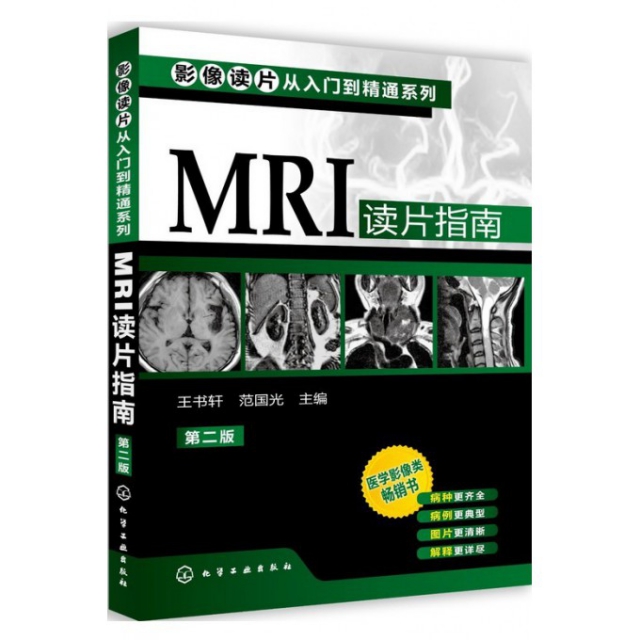 MRI讀片指南(第2