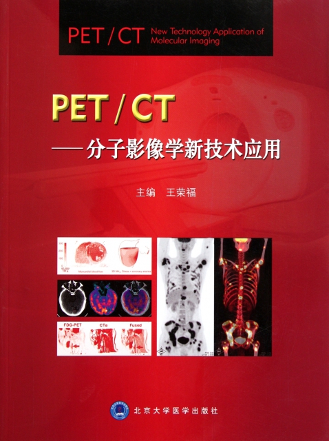 PETCT--分子影像學新技術應用