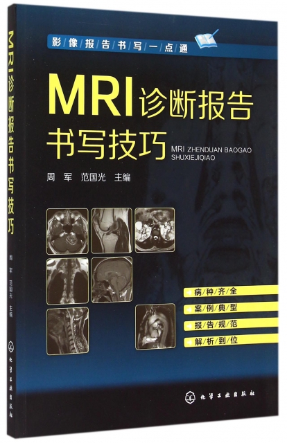 MRI診斷報告書寫技