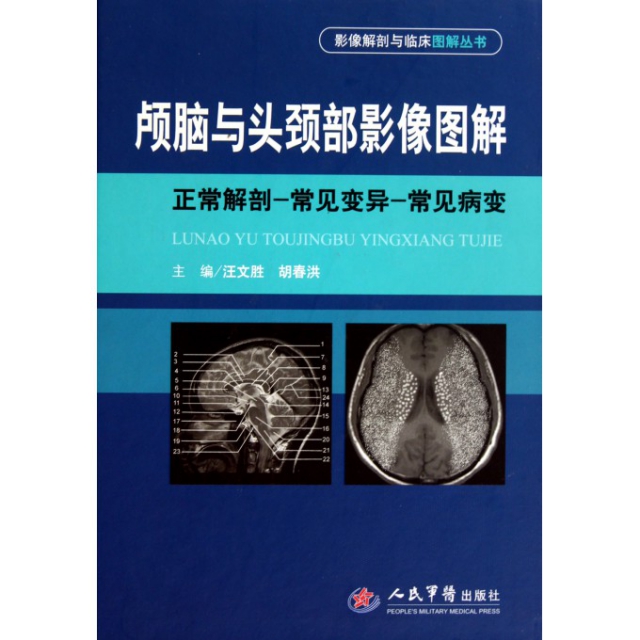 顱腦與頭頸部影像圖解(正常解剖常見變異常見病變)(精)/影像解剖與臨床圖解叢書
