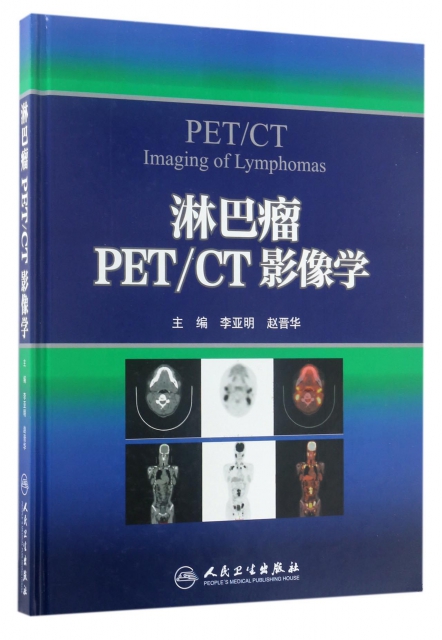淋巴瘤PETCT影像