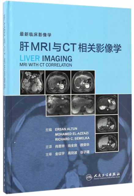 肝MRI與CT相關影像學(精)
